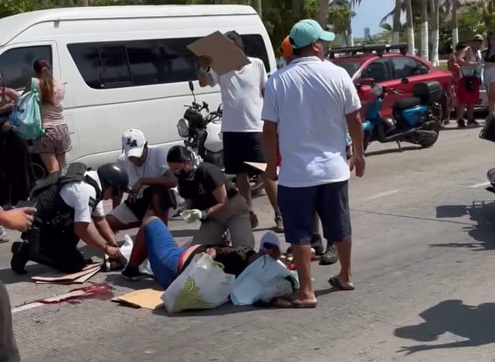 Choque Deja Dos Lesionados En La Avenida Costera De Acapulco Revista